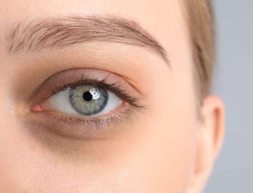 Schlupflider entfernen ohne OP – Botox®, Hyaluron & Plasma