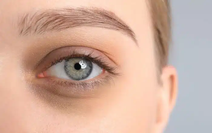 Schlupflider entfernen ohne OP