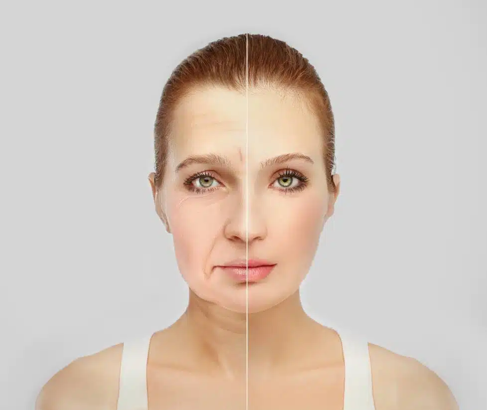 Gesichtsprofil analysieren vor einer nichtoperativen Behandlung